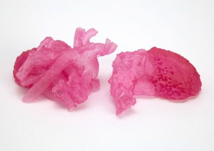 Henkel and NewPro3D collaborate for unique 3D Printing Solution in the medical sector